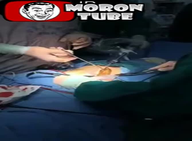 Video :An extraterrestrial worm emerging from his abdomen Just an eel, no!